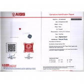 1.04����AIGS���ո�Ѫ��챦ʯ